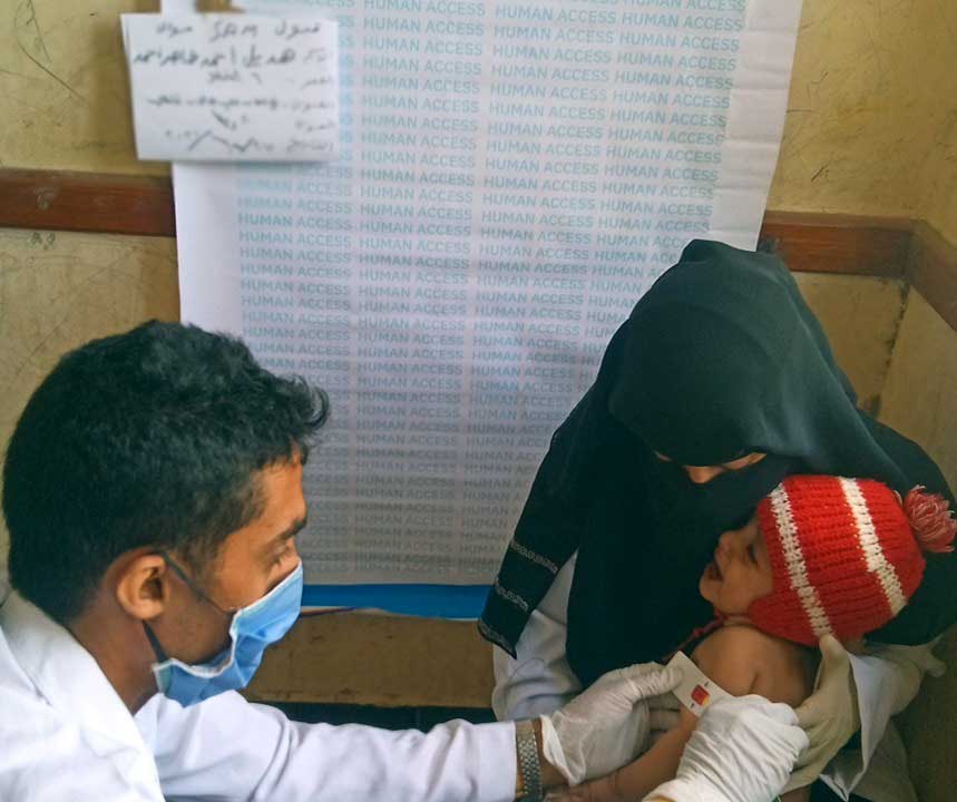 سوء التغذية الحاد الوخيم اليمن
