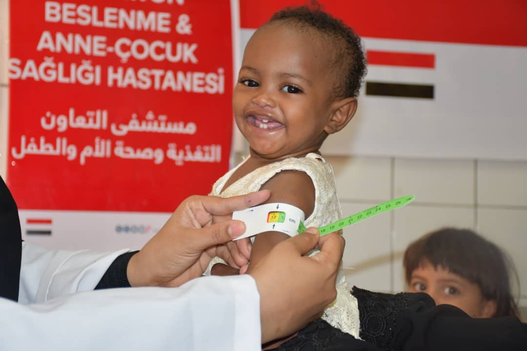 سوء التغذية اليمن