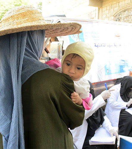 سوء التغذية.. يفتك بأطفال اليمن